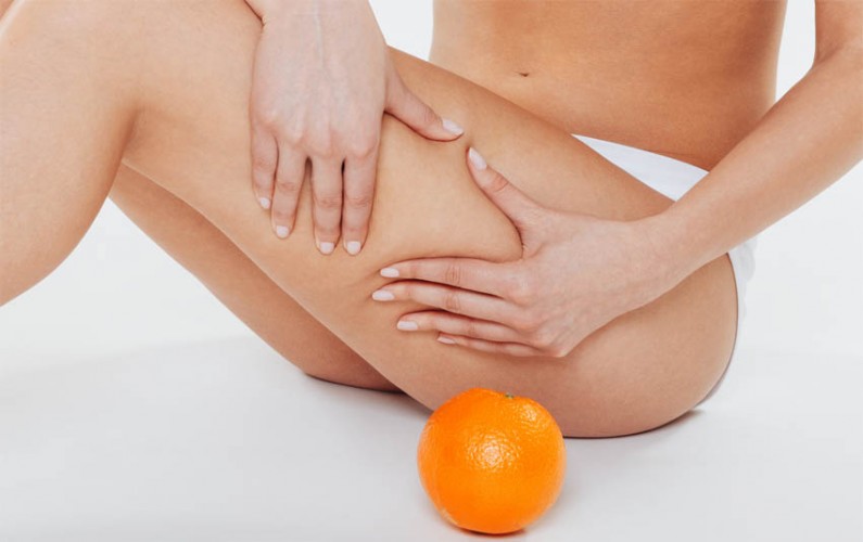 traitement contre la cellulite