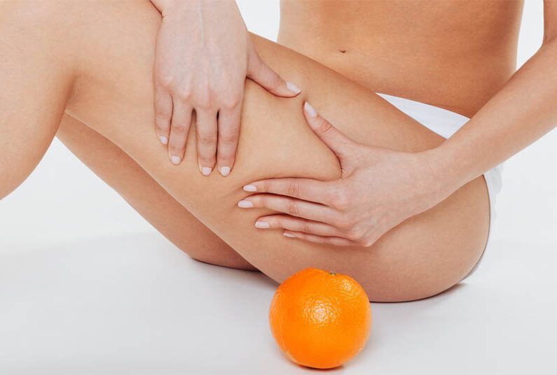 traitement contre la cellulite